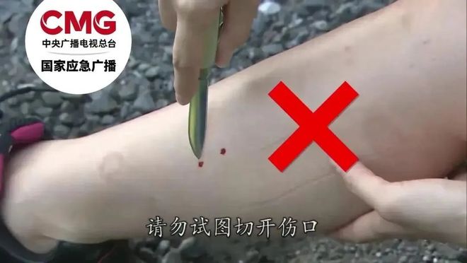 身亡当地曾公布3家医院有抗蛇毒血清麻将胡了免费试玩游客三亚疑被蛇咬(图3)